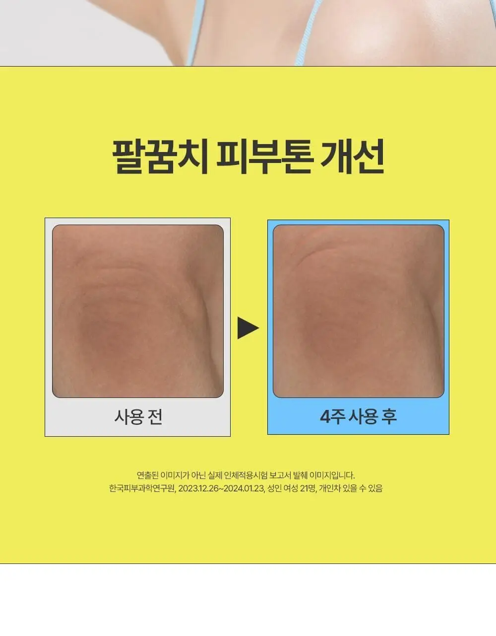 [착색 미백 케어]비클리닉스 나이아신아마이드 5% 브라이트닝 턴온 바디로션 300ml 상세페이지 7